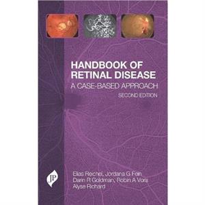 Handbook of Retinal Disease by Alyse Richard