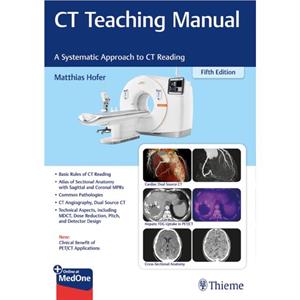 CT Teaching Manual by Matthias Hofer