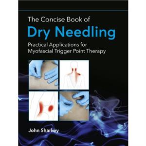 The Concise Book of Dry Needling by John Sharkey