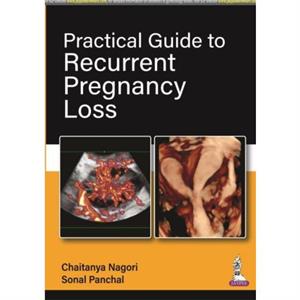 Practical Guide to Recurrent Pregnancy Loss by Chaitanya Nagori