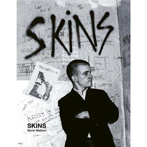 Skins by Gavin Watson