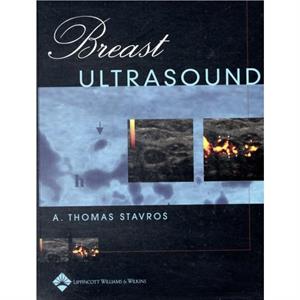 Breast Ultrasound by Stavros & A. Thomas & MD & FACR