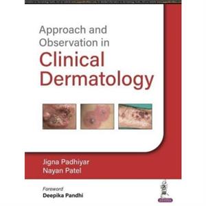 Approach and Observation in Clinical Dermatology by Jigna Padhiyar