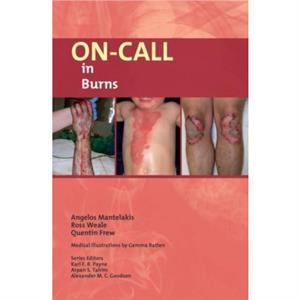 OnCall in Burns by Quentin Frew