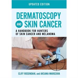 Dermatoscopy and Skin Cancer updated edition by Aksana Marozava