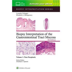 Biopsy Interpretation of the Gastrointestinal Tract Mucosa Volume 1 by ELIZABETH ANNE MONTGOMERY