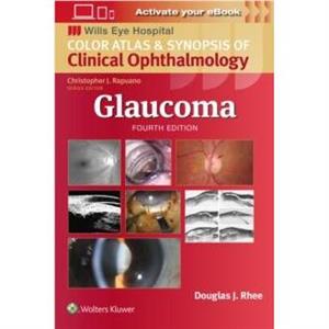 Glaucoma by Douglas J. Rhee