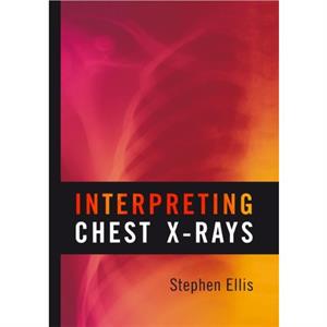 Interpreting Chest XRays by Stephen Ellis