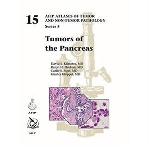 Tumors of the Pancreas by Gunter Kloppel