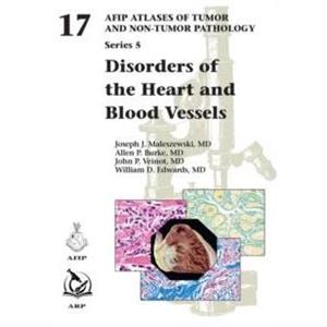 Disorders of the Heart and Blood Vessels by William D. Edwards