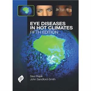 Eye Diseases in Hot Climates by John SandfordSmith