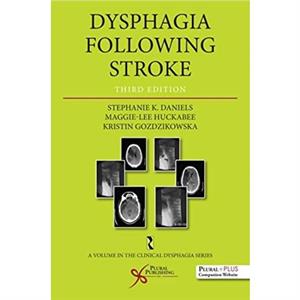 Dysphagia Following Stroke by Kristin Gozdzikowska