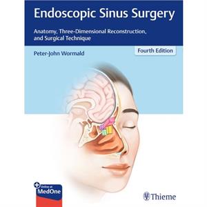 Endoscopic Sinus Surgery by Peter J. Wormald