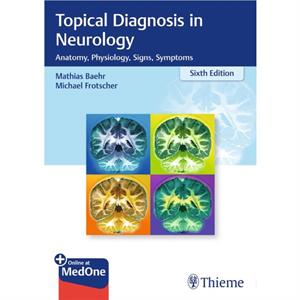 Topical Diagnosis in Neurology by Michael Frotscher