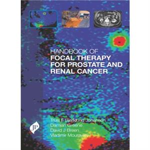 Handbook of Focal Therapy for Prostate and Renal Cancer by Vladimir Mouraviev