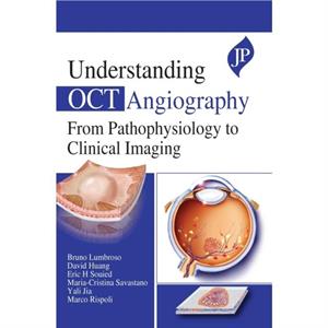 Understanding OCT Angiography by Marco Rispoli