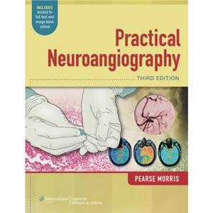 Practical Neuroangiography by P. Pearse Morris