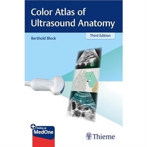 Color Atlas of Ultrasound Anatomy by Berthold Block