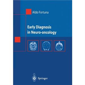 Early Diagnosis in Neurooncology by Aldo Fortuna