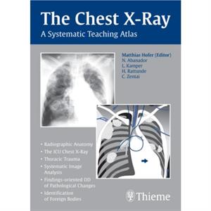 The Chest XRay by Matthias Hofer