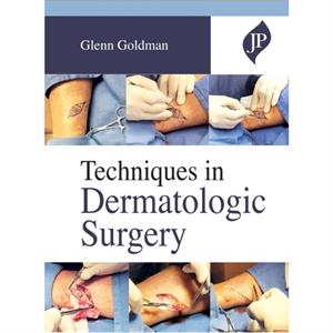 Techniques in Dermatologic Surgery by Glenn Goldman