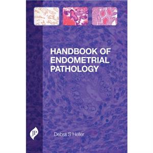 Handbook of Endometrial Pathology by Debra S. Heller