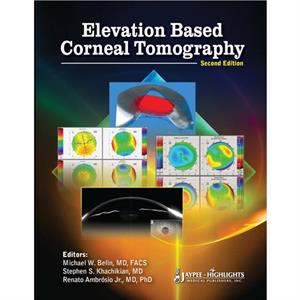 Elevation Based Corneal Tomography by Renato Ambrosio Jr