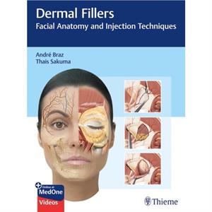 Dermal Fillers by Thais Harumi Sakuma