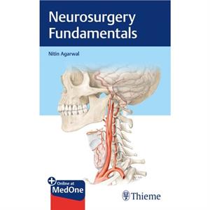 Neurosurgery Fundamentals by Nitin Agarwal