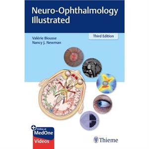 NeuroOphthalmology Illustrated by Nancy Newman