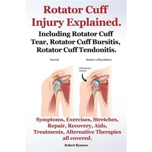 Rotator Cuff Injury Explained. Including Rotator Cuff Tear Rotator Cuff Bursitis Rotator Cuff Tendonitis. Symptoms Exercises Stretches Repair Recovery Aids Treatments Alternative Therapies all covered