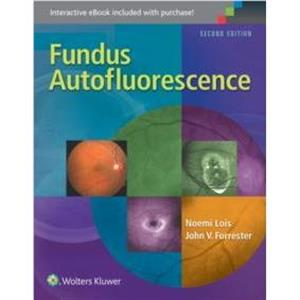 Fundus Autofluorescence by John V. Forrester